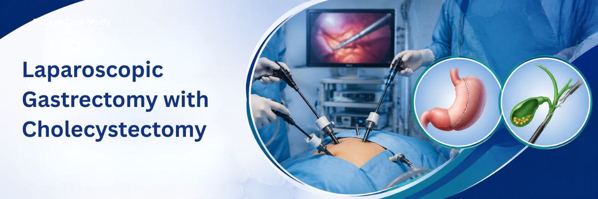 Laparoscopic Gastrectomy with Cholecystectomy