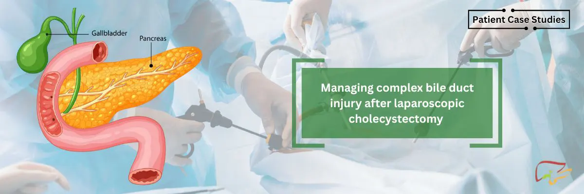 bile duct laparoscopic cholecystectomy