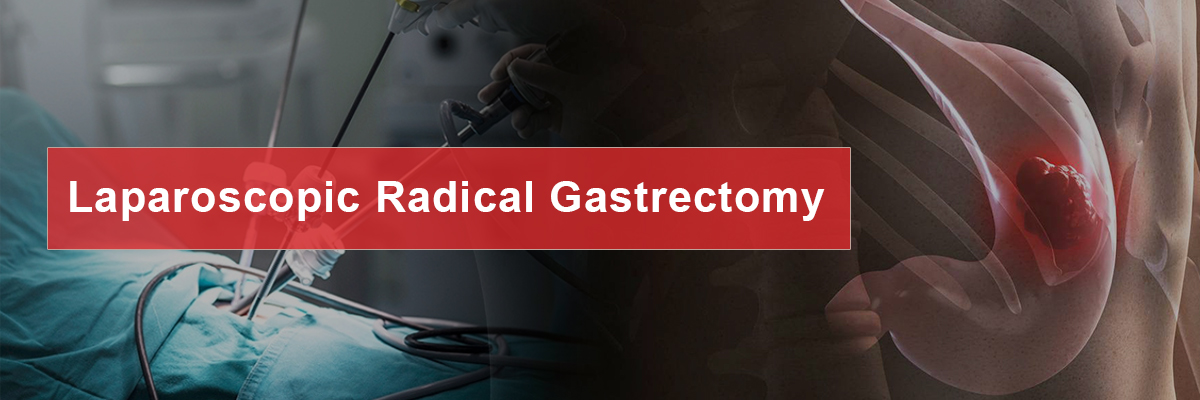 Laparoscopic Radical Gastrectomy Laparoscopic Radical Gastrectomy